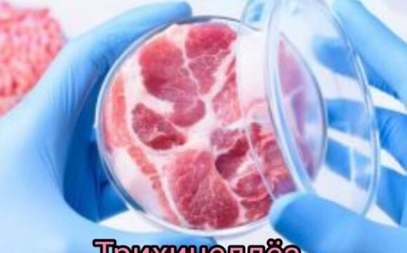 Трихинеллёз