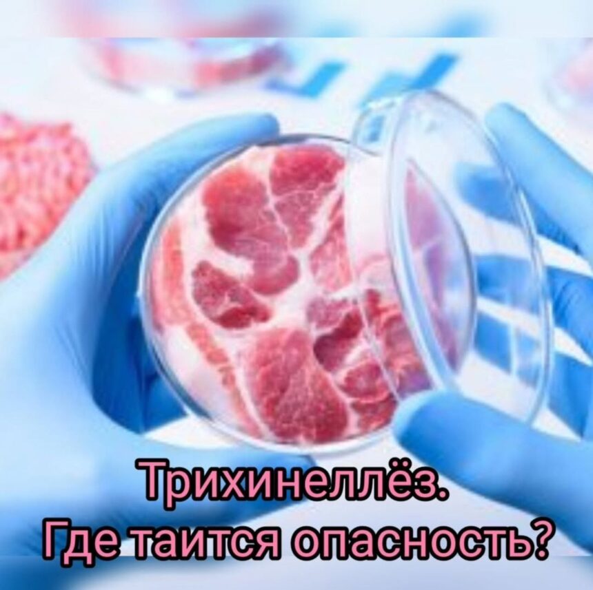 photo_5260567423109240275_y Трихинеллёз